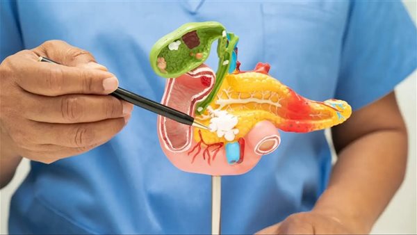 سرطان البنكرياس 