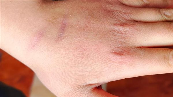 الطفل المجني عليه