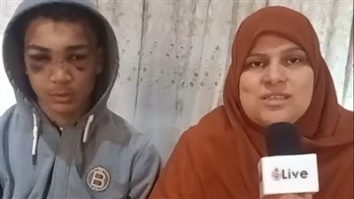 شاب يعتدي على آخر بآلة حديدية في شوارع دمياط.. والضحية: ضايقني بالليزر وبقوله عيب ضربني هوا وأخوه | بث مباشر