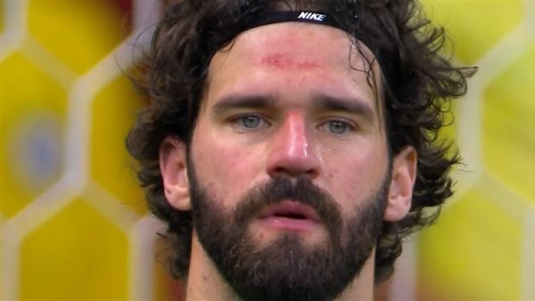 إصابة أليسون في مباراة