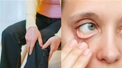 نقص عناصر غذائية شائعة بالجسم يضر بصحة المرأة .. تعرف على التفاصيل