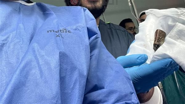 جانب من العملية 