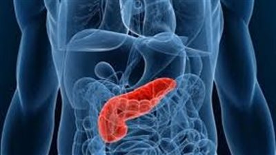 باحثون يحددون عوامل الإصابة بسرطان البنكرياس مرتبطة بنمط الحياة 
