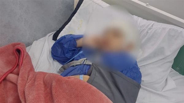 صورة الطفل عقب الجراحة