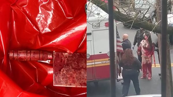 أمريكي يهاجم صغارًا