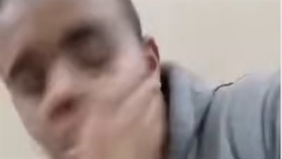 صديق طبيب الأسنان المصفوع على يد فتاة داخل عيادته: كانت ممرضة عنده ورفض خطبتها