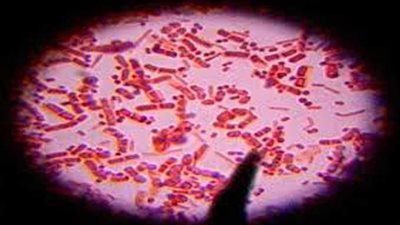 الجمرة الخبيثة تقتل 50 فرس نهر في منتزه فيرونجا بالكونغو