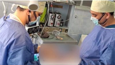 فريق طبي بمستشفى صدر المعمورة في الإسكندرية ينقذ مريضًا من خراج رئوي كبير