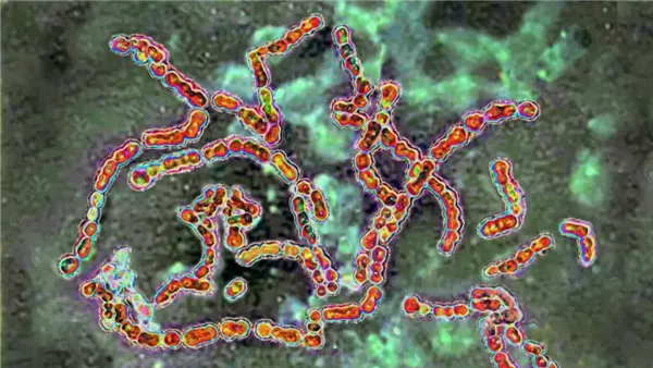 صورة تعبيرية 