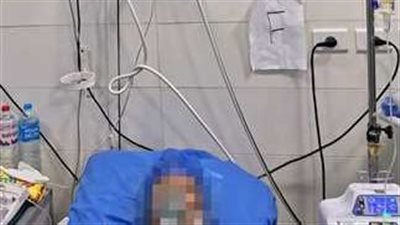 بجراحة دقيقة.. الفريق الطبي بمستشفى شرق المدينة ينقذ حياة مريضة قبل توقف عضلة القلب