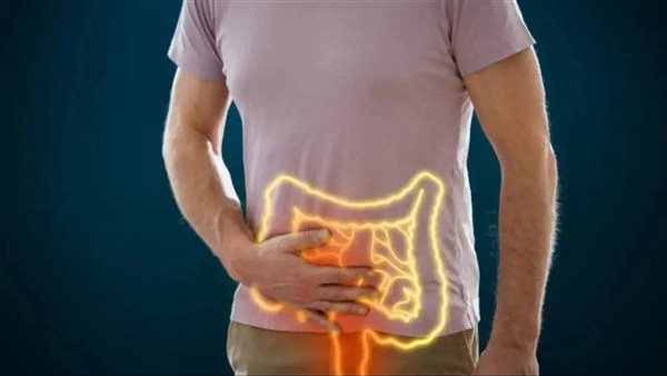 القولون العصبي ـ