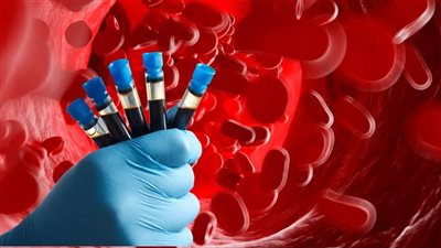 طرق تحسين مستويات الهيموجلوبين بالجسم 