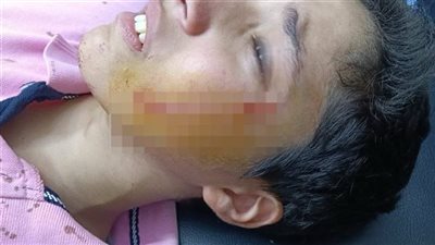 رفض مساعدته في الغش.. إحالة الطالب المتهم بالتعدي على زميله بالبدرشين للمحاكمة الجنائية