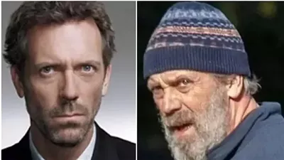 غير قابل للتعرف عليه... ظهور صادم لـ هيو لوري نجم مسلسل House في حديقة عامة