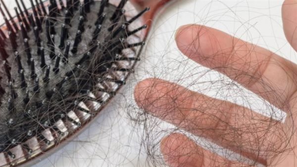 تساقط الشعر 