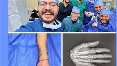 كنا 10 أطباء واستغرقنا 12 ساعة.. أول تعليق من دكتور بطب الأزهر نجح في إعادة يد شاب بعد بترها بالكامل 
