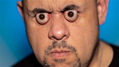 تيك توكر يدخل موسوعة جينيس بسبب حجم عينه.. ما القصة؟