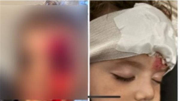 الطفل المصاب