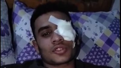 شاب يفقد عينه خلال دفاعه عن زميلات العمل بطنطا: عايز حقي| بث مباشر 