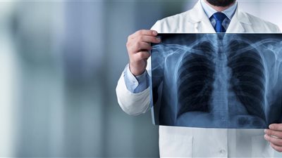 الصحة: تقديم 784 ألف خدمة طبية بمستشفيات الأمراض الصدرية خلال الربع الأول من العام الجاري