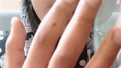 القومي لحقوق الإنسان يتقدم ببلاغ رسمي ضد أب بتهمة تعذيب ابنتيه في الوادي الجديد