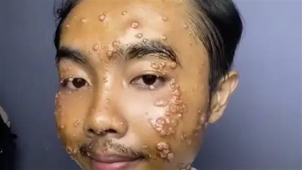 الشاب المصاب