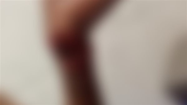 الشاب المصاب