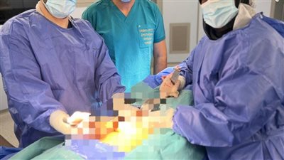 للمرة الأولى في مصر.. فريق طبي بجامعة المنصورة يُجري جراحة نادرة للحفاظ على خصوبة مريضات السرطان
