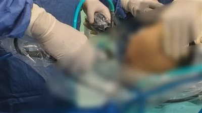 جلطة حادة بالشريان الرئوي.. نص تقرير الطب الشرعي لحفيدة رئيس الوزراء الأسبق المتوفاة بسبب حقنة فيلر