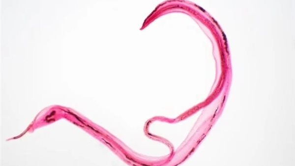 دودة طفيلية