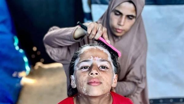 الطفلة لانا