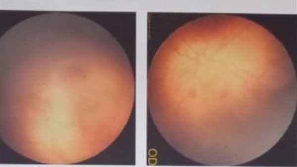 جانب من العملية 