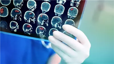 بعد إلغائه جولته الغنائية.. ما هي متلازمة استسقاء الرأس ذي الضغط الطبيعي المصاب به المغني الأمريكي الشهير بيلي جويل؟