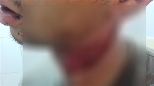 الطالب المصاب 