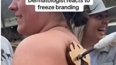 خبير يحذر من صيحة جديدة في عالم التجميل تزيد من خطر الإصابة بالسرطان