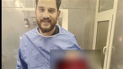 استئصال طحال.. مستشفى دمياط العام ينجح في إنقاذ حياة طفل من الموت