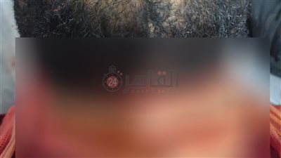 مصدر بمستشفى الفيوم العام: استقرار الحالة الصحية لعامل محل الكشري المصاب بجرح في الرقبة