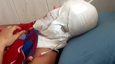 شقيقة طالب جامعي بالشرقية تكشف تفاصيل اعتداء شابين عليه: كسروا جمجمته وصفوا عينه علشان قالهم صلحوا التوك توك |صور