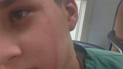 غششني لاعورك.. الحبس عامين لوالد الصغير المتهم بالاعتداء على زميله أمام مدرسة بالبدرشين