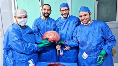 نجاح طبي جديد.. استئصال ورم ضخم أنقذ حياة فتاة بمستشفى الفيوم العام