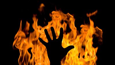 3 في العمليات و4 بالعناية المركزة.. الحالة الصحية لمصابي تسرب زيت مصنع لحوم بالإسماعيلية