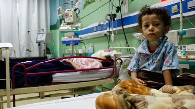 مستشفى أبو الريش: 600 جراحة و1000 قسطرة قلبية للأطفال نجريها سنويًا