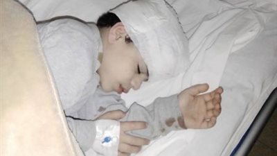 الاعتداء على طفل داخل مدرسة في المقطم بطريقة وحشية وسط إهمال المعلمين (صور)