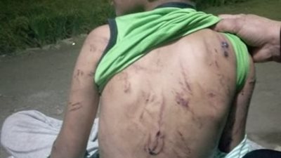 ننشر صور آثار تعذيب زوج أم لطفلين بالقليوبية