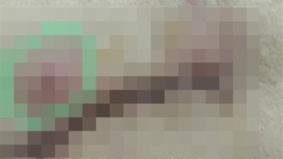 عملها عملية غير المتفق عليها وأصابها بالشلل.. فتاة تتهم طبيبا شهيرا بالتسبب في وفاة والدتها