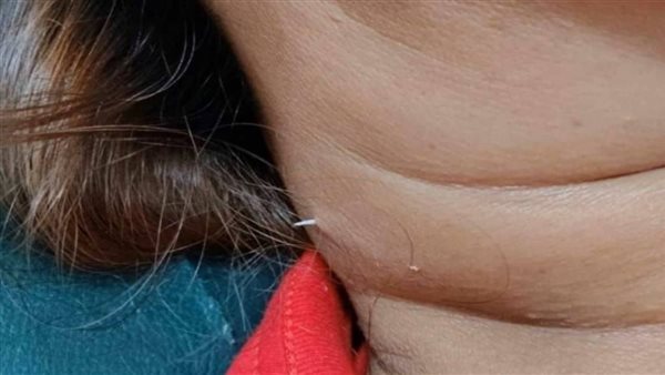 رقبة المرأة التيلاندية