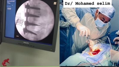 جراحات دقيقة تنقذ 3 شابات من الشلل في مستشفى تمى الأمديد.. ووكيل صحة الدقهلية يشيد بالإنجاز