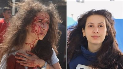 وسط مزاعم تدخل الذكاء الاصطناعي.. الصحفية الفلسطينية بيان أبو سلطان تتصدر التريند بسبب إصابتها 