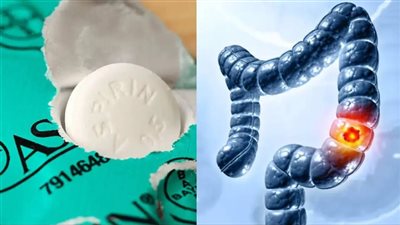 دواء شائع لتسكين الألم يمكن أن يقلل من خطر الإصابة بسرطان الأمعاء | دراسة