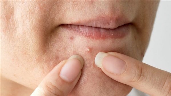 صورة أرشيفية لحبوب